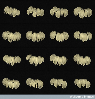 Illustration for article titled This Is How Your Fruits and Vegetables Look in an MRI Machine
